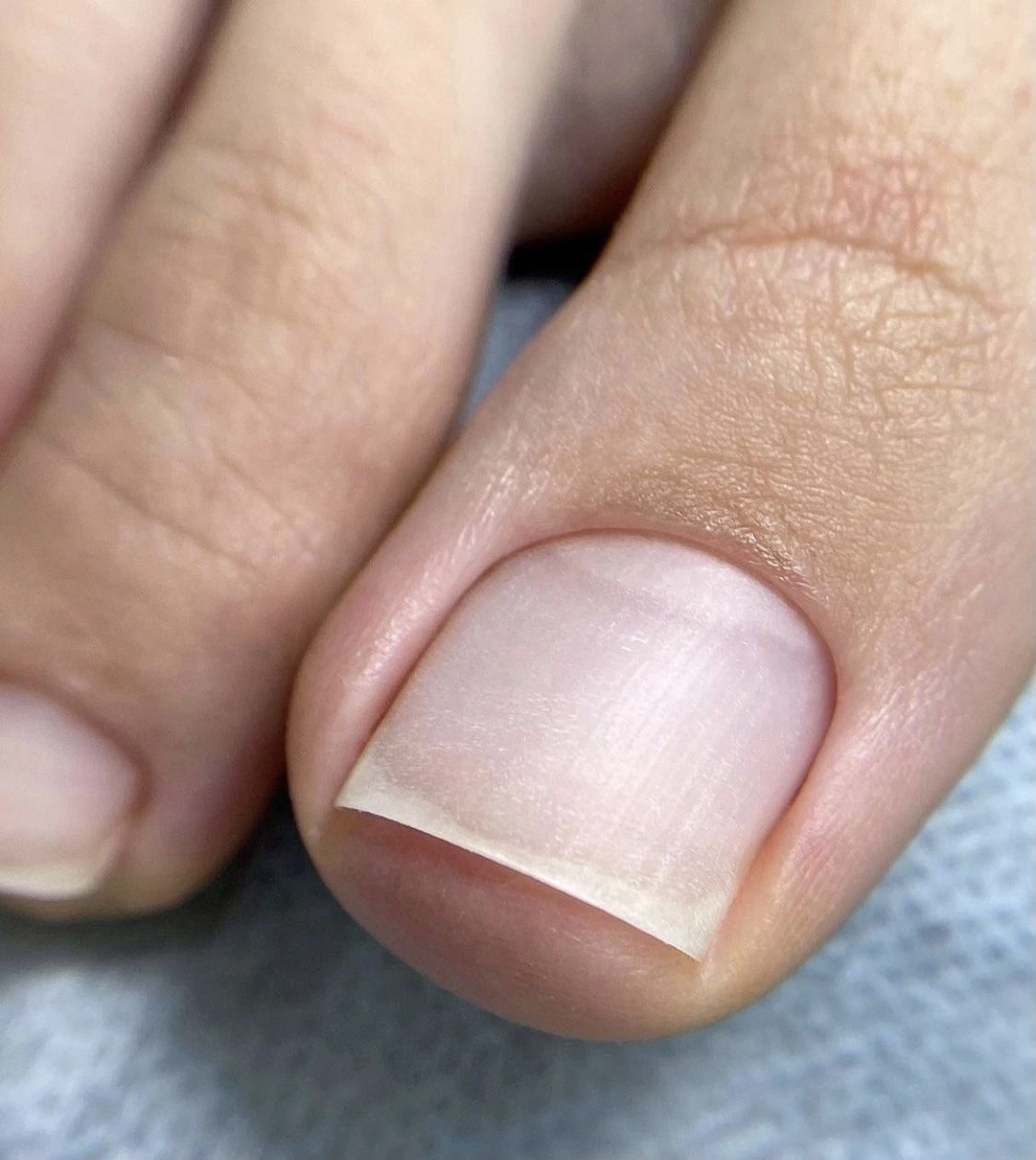 SMART ΠΏΠ΅Π΄ΠΈΠΊΡΡ Π±Π΅Π· ΠΏΠΎΠΊΡΡΡΠΈΡ